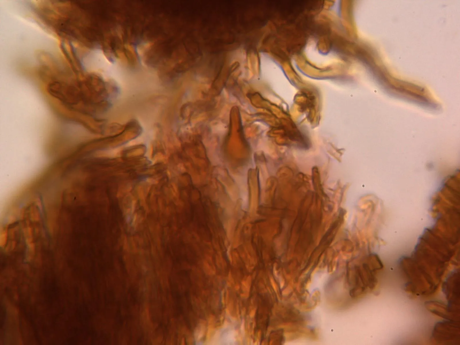 Microscopía de Phellinus igniarius - 10 - Seta himenial